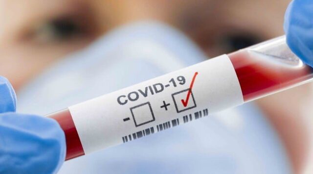 Otro caso positivo de coronavirus en Embalse-La Ola Digital