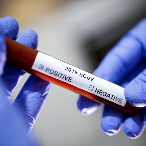 Embalse informó un caso positivo de coronavirus-La Ola Digital