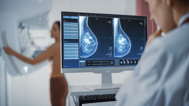 Santa Rosa: ya se pueden retirar los estudios realizados en el mamógrafo móvil-La Ola Digital