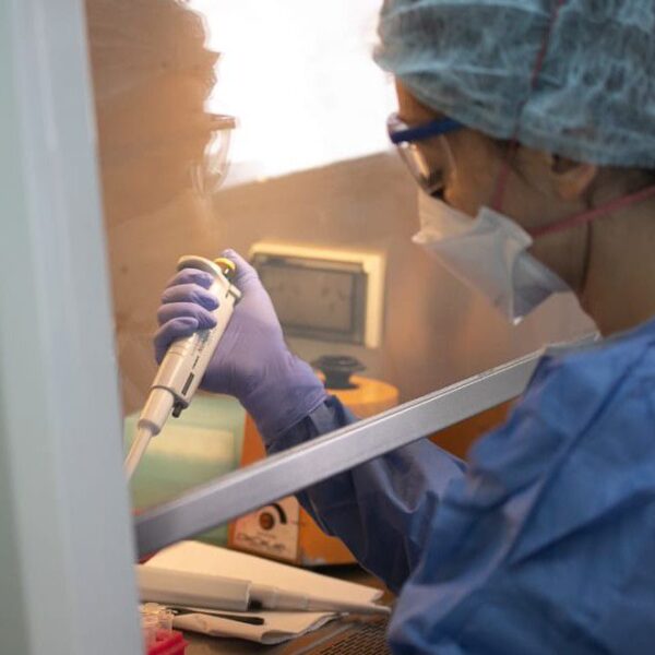 Viruela símica: se confirmaron dos nuevos casos en la provincia-La Ola Digital