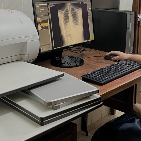 Los Cóndores incorporó nueva tecnología en salud con un moderno sistema de revelado digital-La Ola Digital