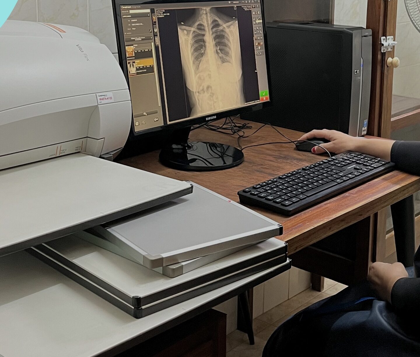 Los Cóndores incorporó nueva tecnología en salud con un moderno sistema de revelado digital-La Ola Digital